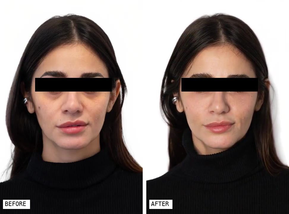 Content for aesthetic medicine